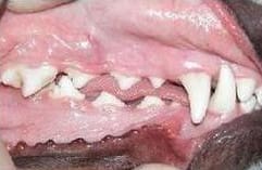 Healthy teeth and gums